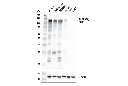 TNFRSF8/CD30 (E4L4I) XP Rabbit mAb
