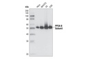 PP2A B Subunit (100C1) Rabbit mAb