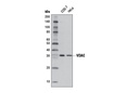 VDAC (D73D12) Rabbit mAb (HRP Conjugate)