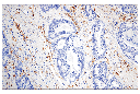 IGFBP7 (E3Z8L) XP Rabbit mAb