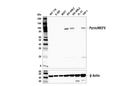 Pyrin/MEFV (E2E8U) Rabbit mAb