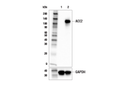 ACE2 (E5O6J) XP<lt/>sup&gt; <lt/>/sup&gt; Rabbit mAb