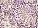 蛋白酶体PSMa6抗体