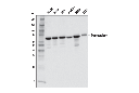 Transketolase (E7O4M) Rabbit mAb