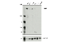 Homologous Recombination (HR) DNA Repair Antibody Sampler Kit